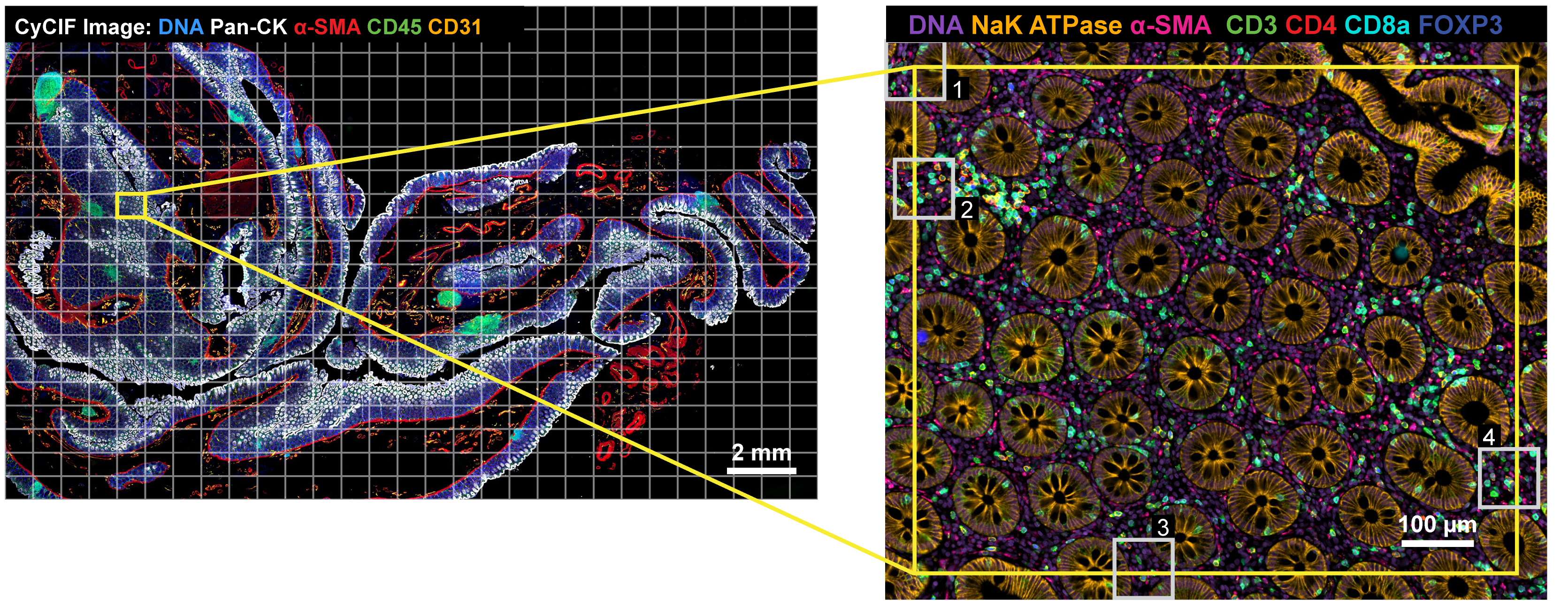 Example Data: Full tiled mosaic image of colon sample and a higher magnification inset at tile overlap region.