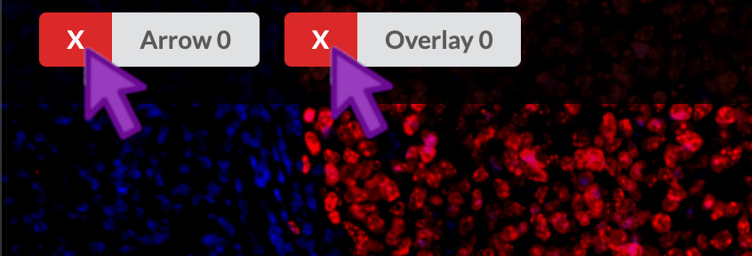 Delete arrows or overlays